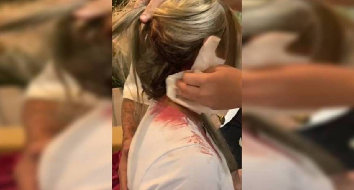 Vizinha acusa mulher de "estumar" cachorro para mordê-la e levar pedrada