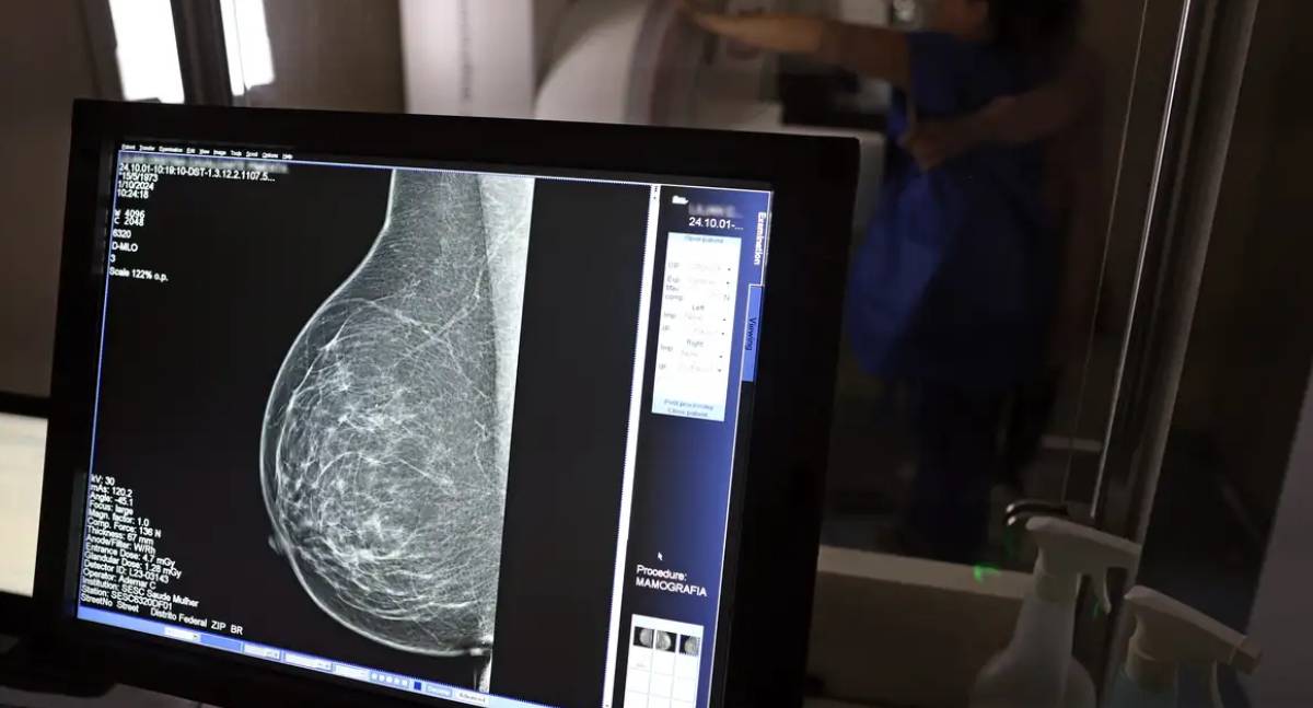 Disparidade na mamografia limita prevenção do câncer de mama no Brasil