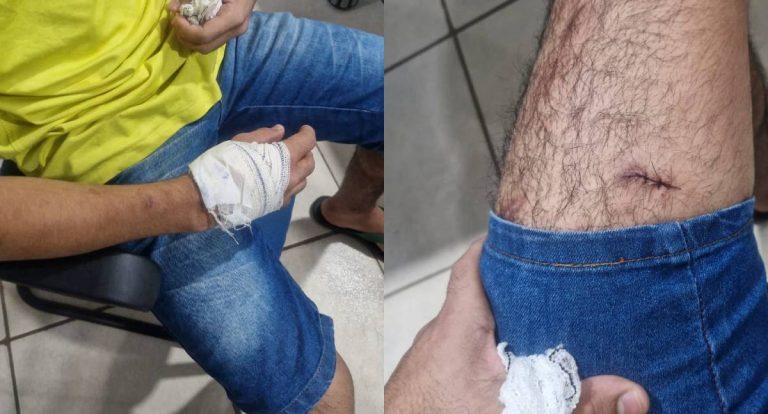 Jovem de 18 anos é esfaqueado pela esposa após discussão no Porto Madeira 3, em Porto Velho