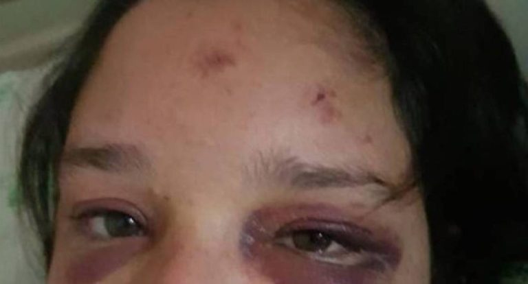 Mulher é agredida e ameaçada pelo ex-marido em Rondônia