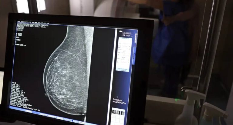 Outubro Rosa: INSS oferece auxílio-doença e BPC para mulheres em tratamento de câncer