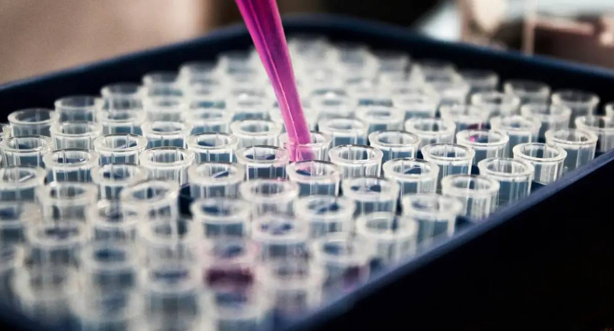 Pesquisa brasileira valida exame de sangue para diagnóstico de Alzheimer