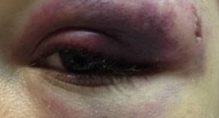 Briga em casa de shows no Setor Chacareiro deixa duas mulheres feridas