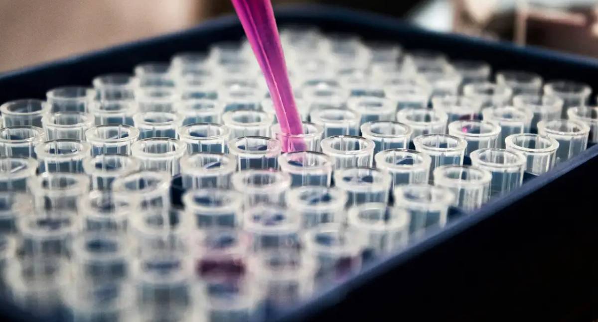 Estudo sugere que inflamação é chave para o estabelecimento e progressão do Alzheimer