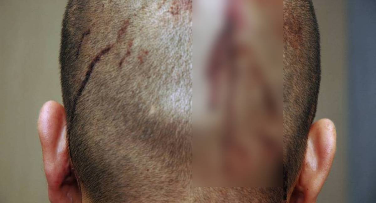 Jovem de 21 anos é espancado em briga na saída de casa noturna em RO