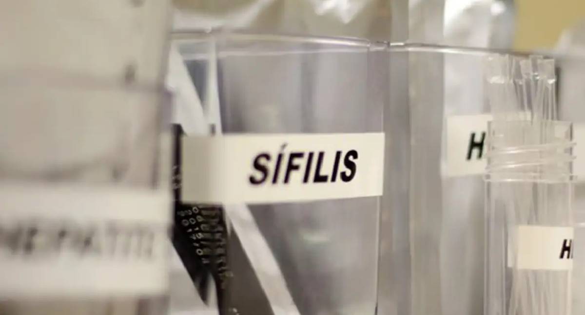 Sífilis mantém crescimento acelerado no Brasil e preocupa especialistas