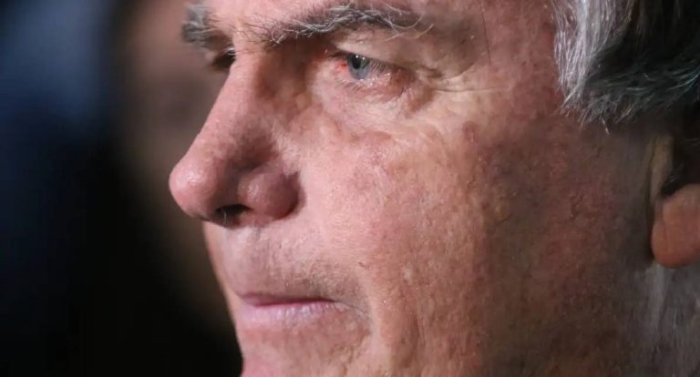 Bolsonaro passa por nova cirurgia devido a crises de soluços