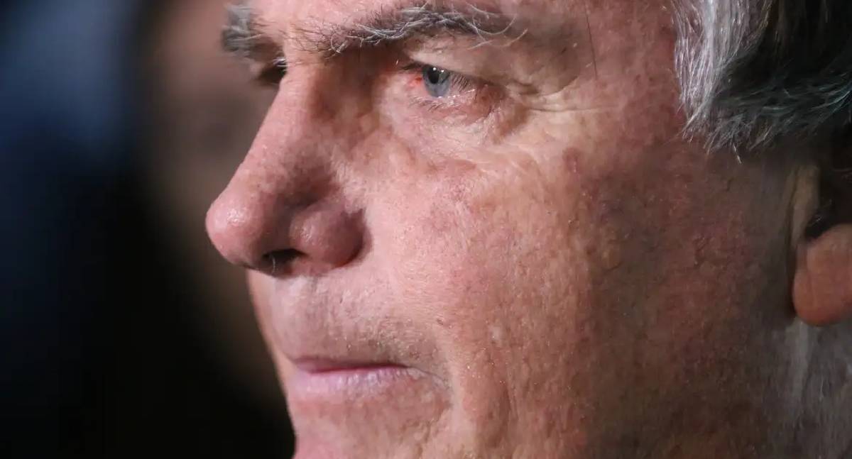 Bolsonaro passa por nova cirurgia devido a crises de soluços