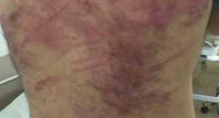 Homem agredido com fio por dupla em moto é socorrido em campo de futebol