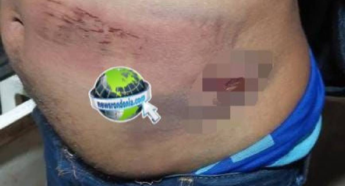 Homem é agredido a pauladas e tem casa invadida por sobrinhos da esposa em Porto Velho
