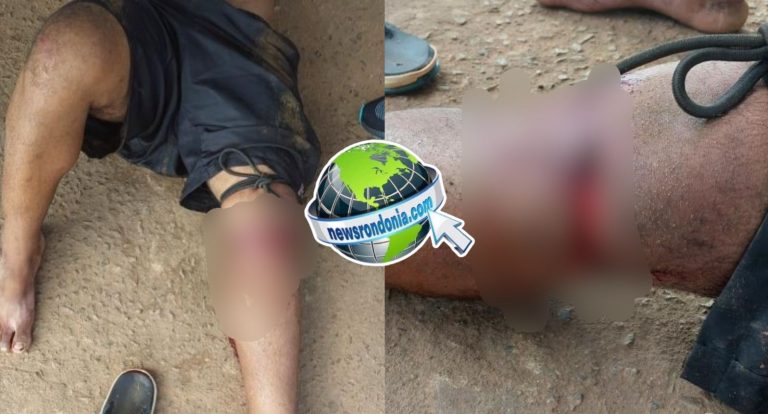 Homem é atacado a golpes de facão por Venezuelano na zona leste