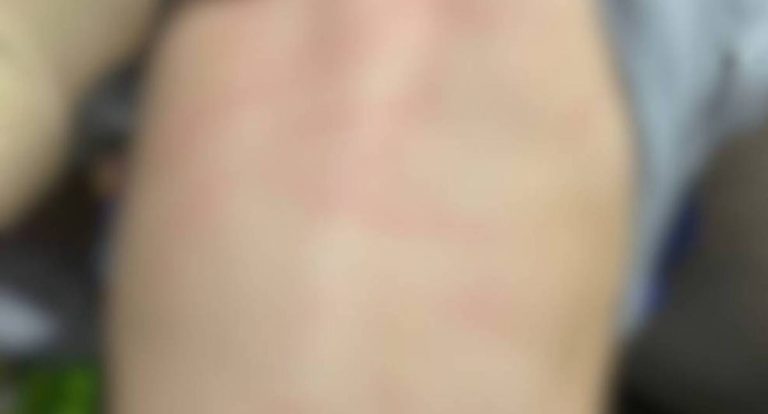 Mulher é presa após agredir filha de 12 anos com socos e mordidas