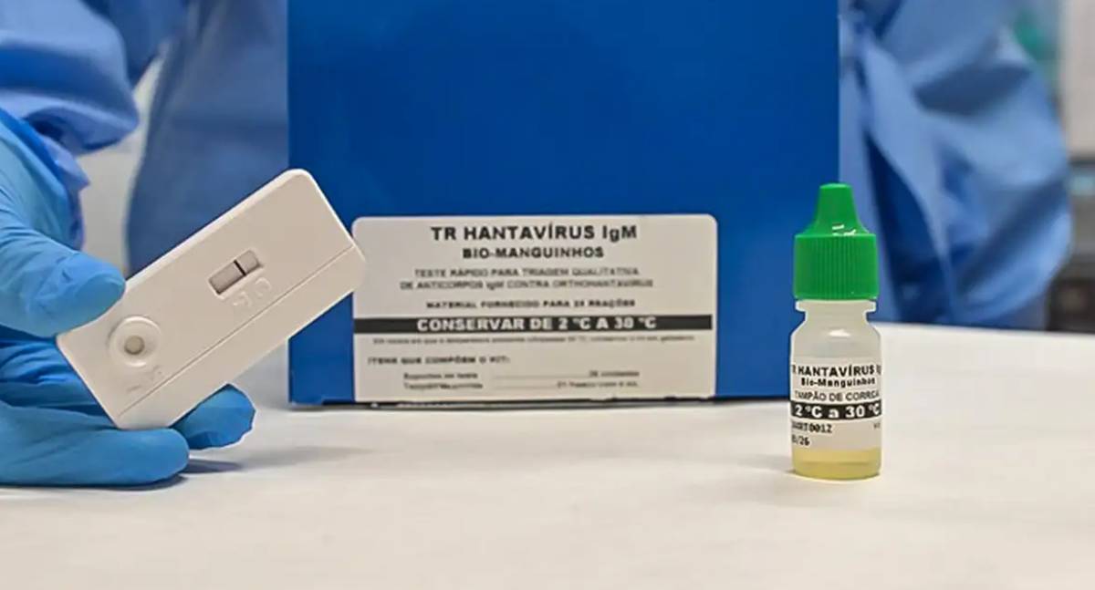 Novo teste desenvolvido por Fiocruz e UFRJ diagnostica hantavirose em 20 minutos