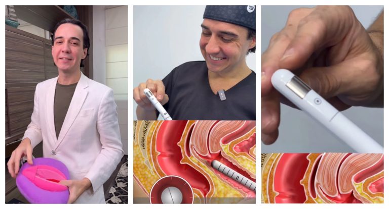 retraction-intimo-saude-feminina-rondonia