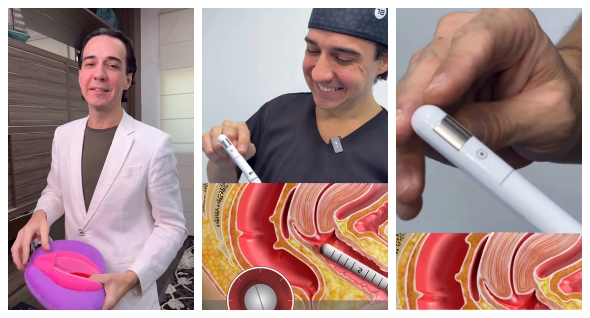 retraction-intimo-saude-feminina-rondonia