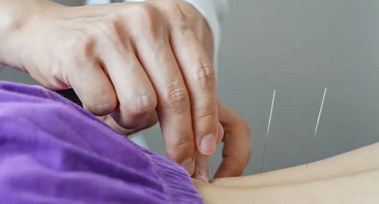 Governo federal regulamenta o exercício profissional da acupuntura