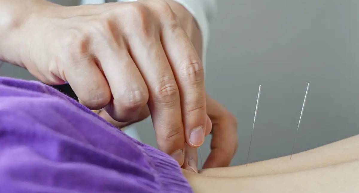 Governo federal regulamenta o exercício profissional da acupuntura