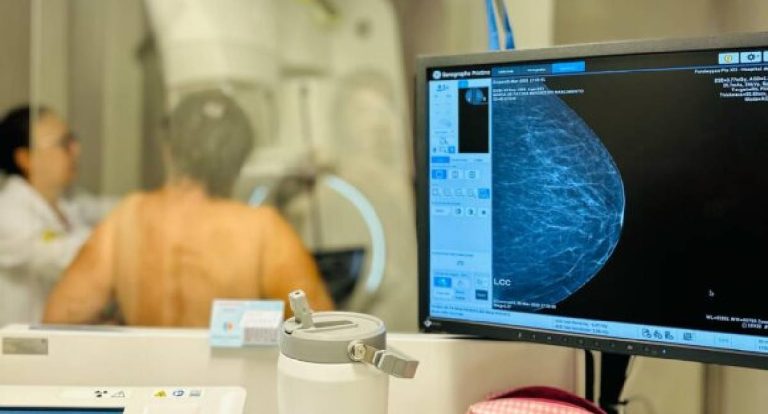 Carreta do Hospital de Amor abre inscrições para exames gratuitos em Jaru