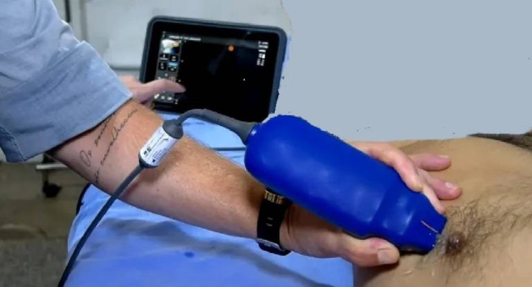 IA agiliza exames no João Paulo II