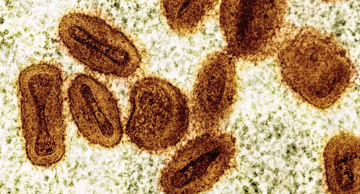 Mais dois casos de mpox são confirmados em Rondônia