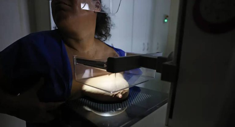 Mamografia atinge 92% das brasileiras entre 50 e 69 anos