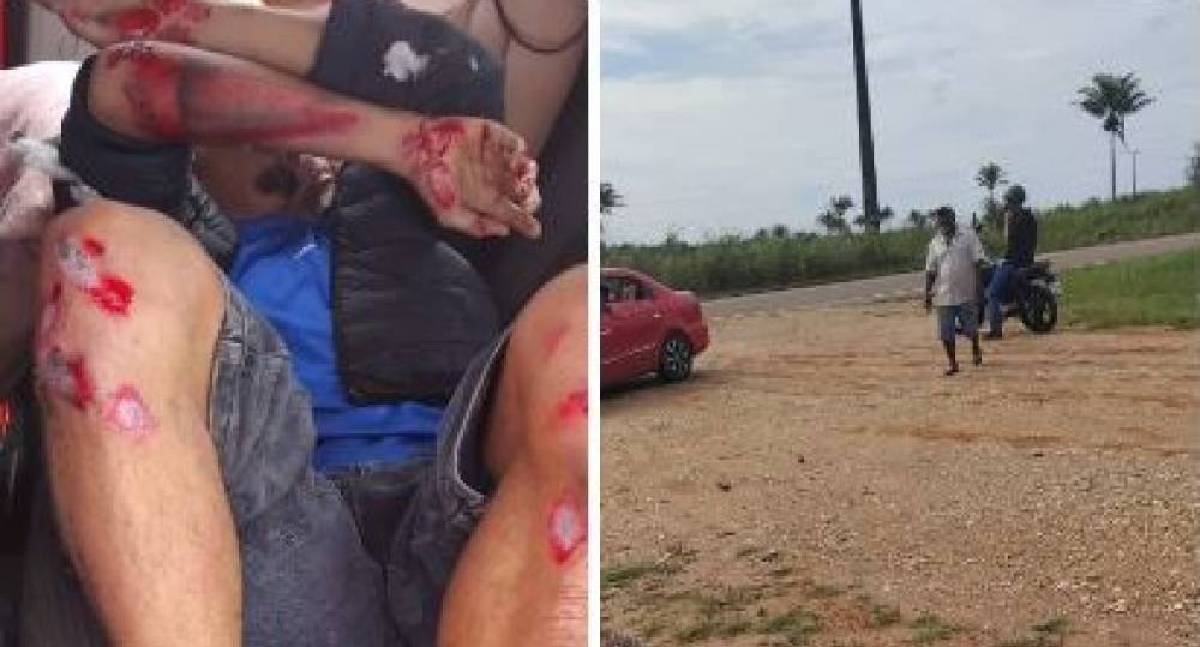 Motociclista se fere após atingir buraco na BR-435