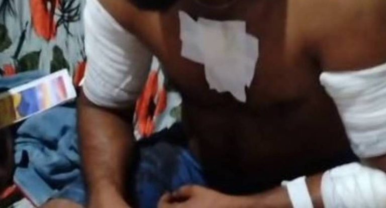 Homem sobrevive a sete facadas desferidas pela esposa em RO