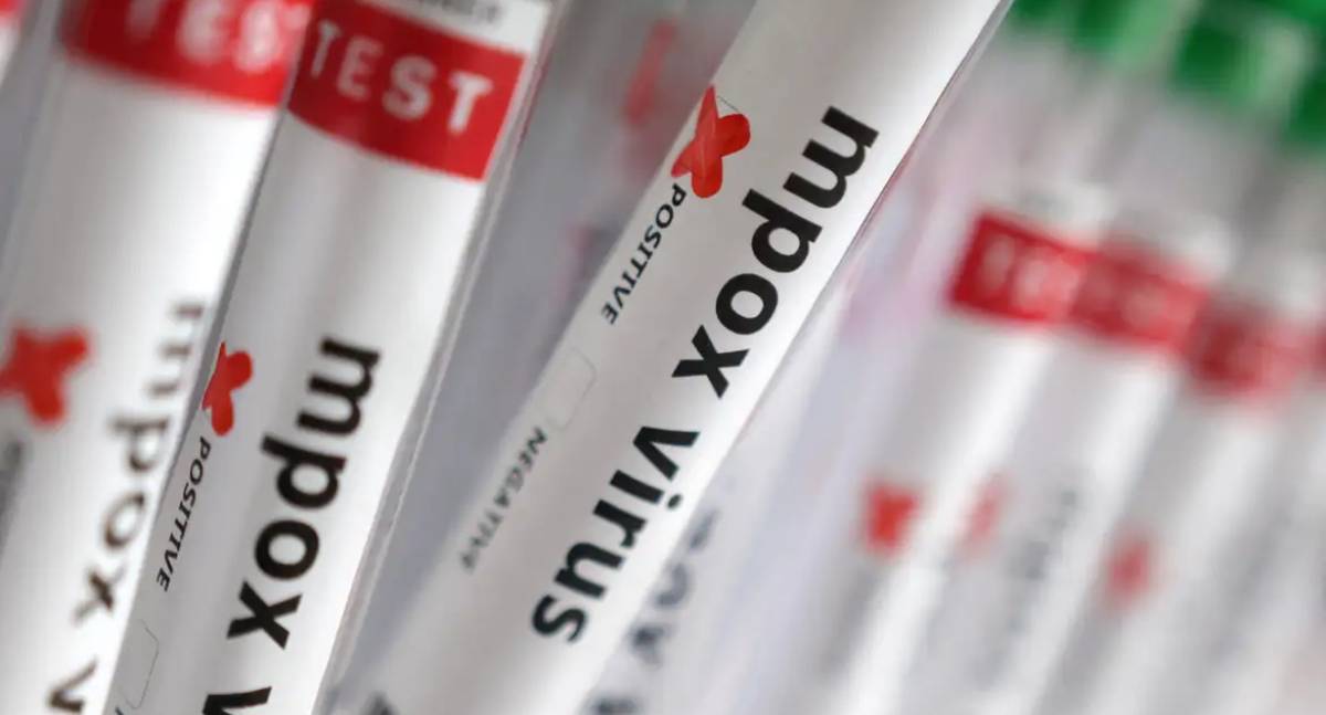 Ministério da Saúde confirma 140 casos de Mpox no Brasil em 2026