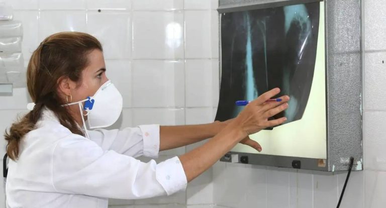 OMS recomenda testes de diagnóstico rápido para erradicar tuberculose