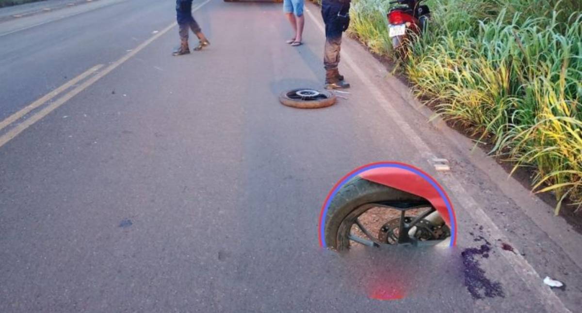 Pai sofre fratura exposta na RO-479 ao cair em buraco enquanto socorria o filho