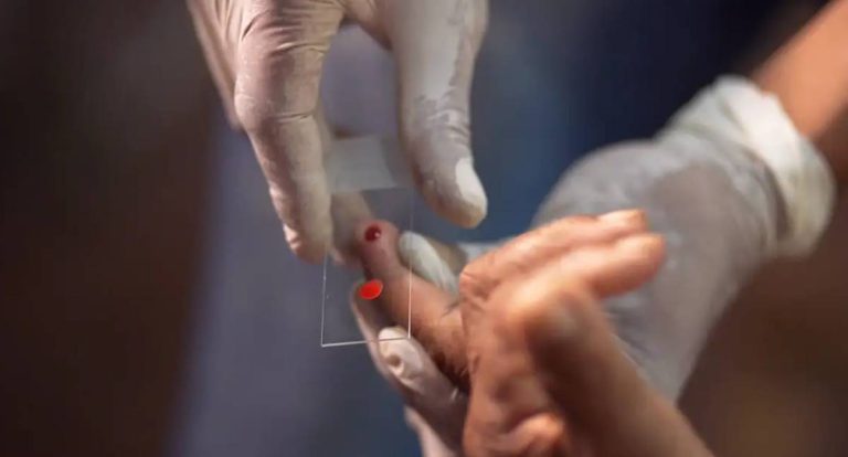 SUS inicia uso de novo tratamento em dose única contra malária infantil