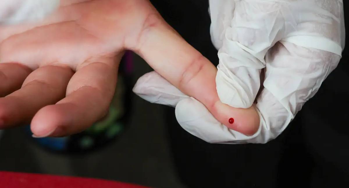 SUS passa a oferecer teste rápido para diagnóstico da dengue