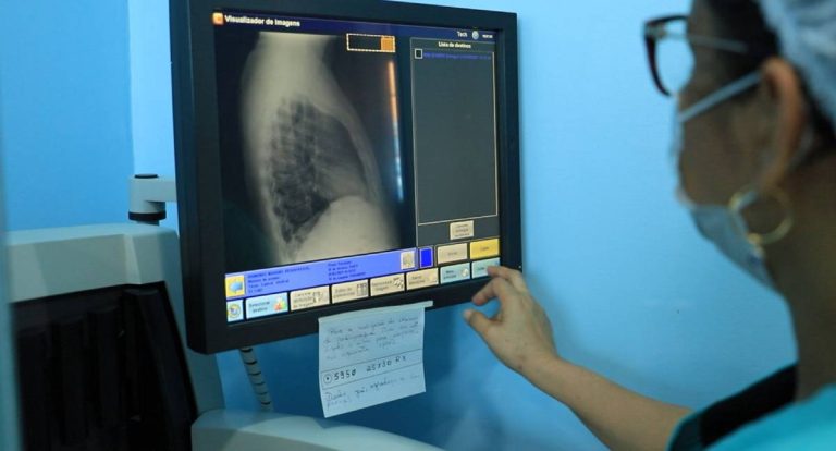 Tuberculose: Semusa inicia ações educativas para combater abandono de tratamento