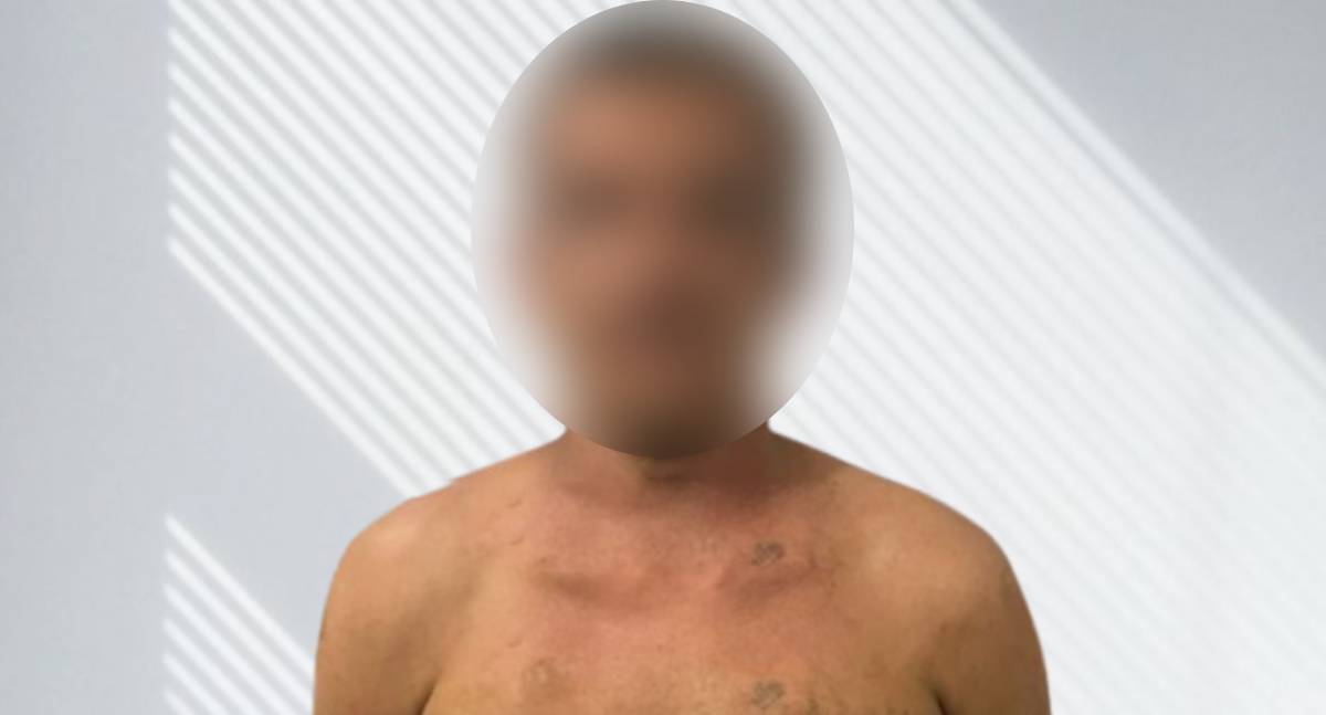 Suspeito é detido por colegas após roubo em RO