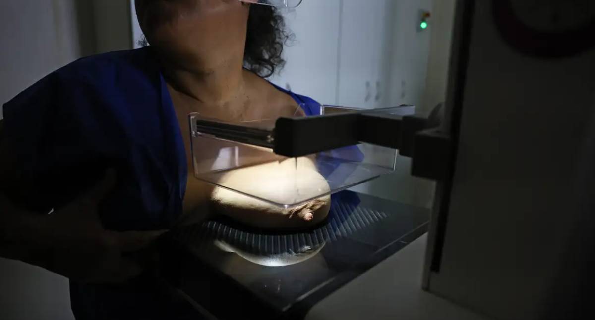 ANS propõe ampliar cobertura de mamografia digital
