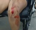 Criança de 8 anos aciona PM após pai agredir mãe e deixá-la desacordada em RO