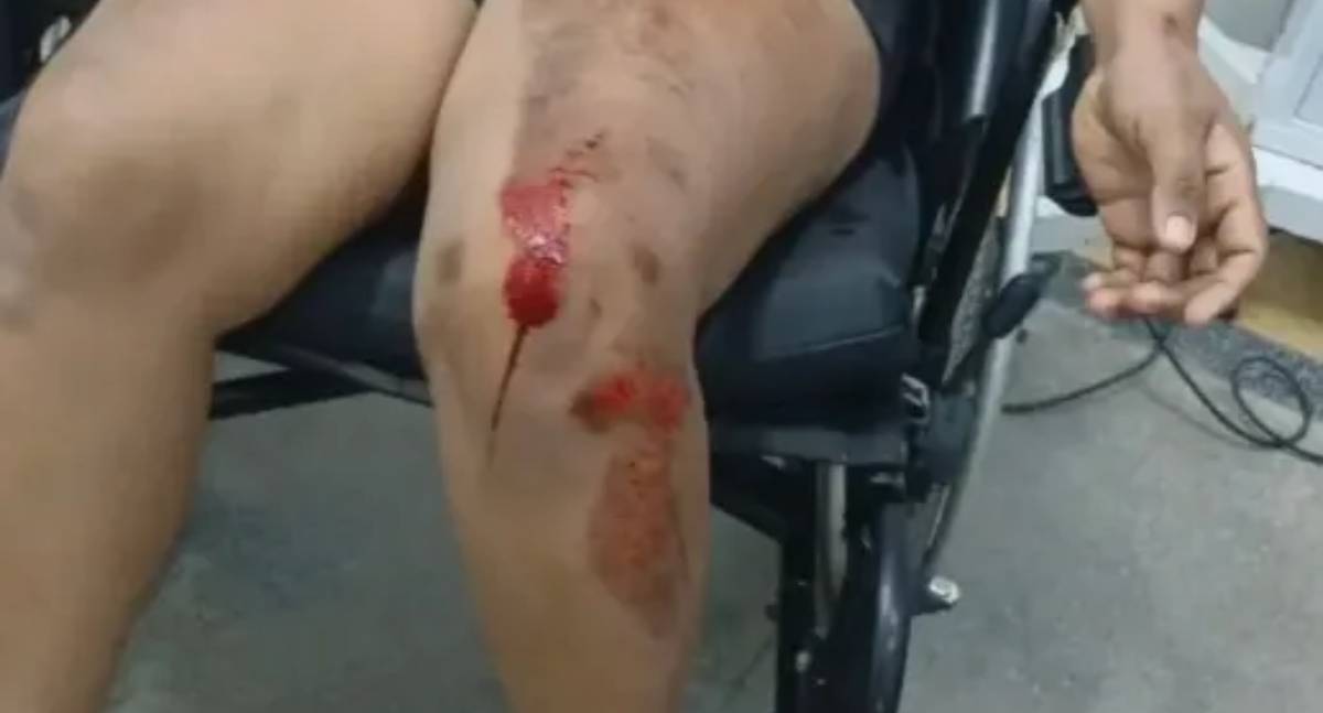 Criança de 8 anos aciona PM após pai agredir mãe e deixá-la desacordada em RO