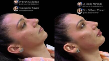 Agenda News: Você conhece o Full Face?