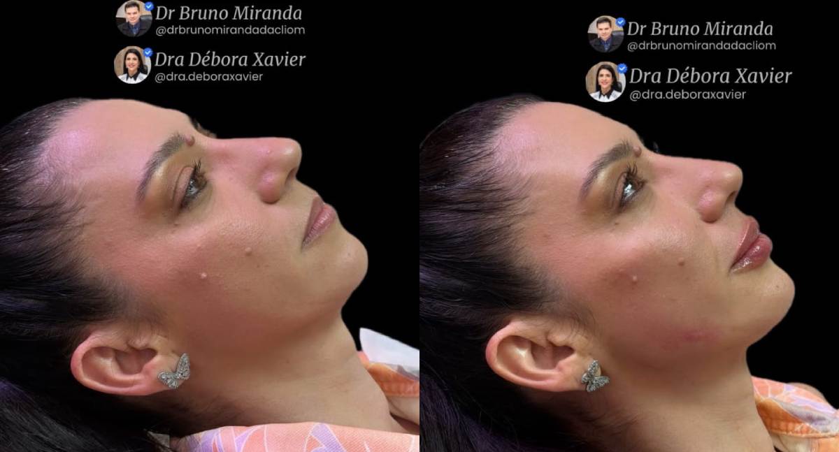 Agenda News: Você conhece o Full Face?