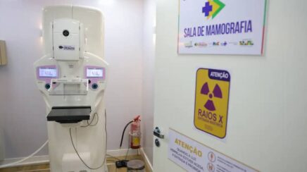 Cirurgias plásticas mamárias no SUS crescem mais de cinquenta por cento em uma década