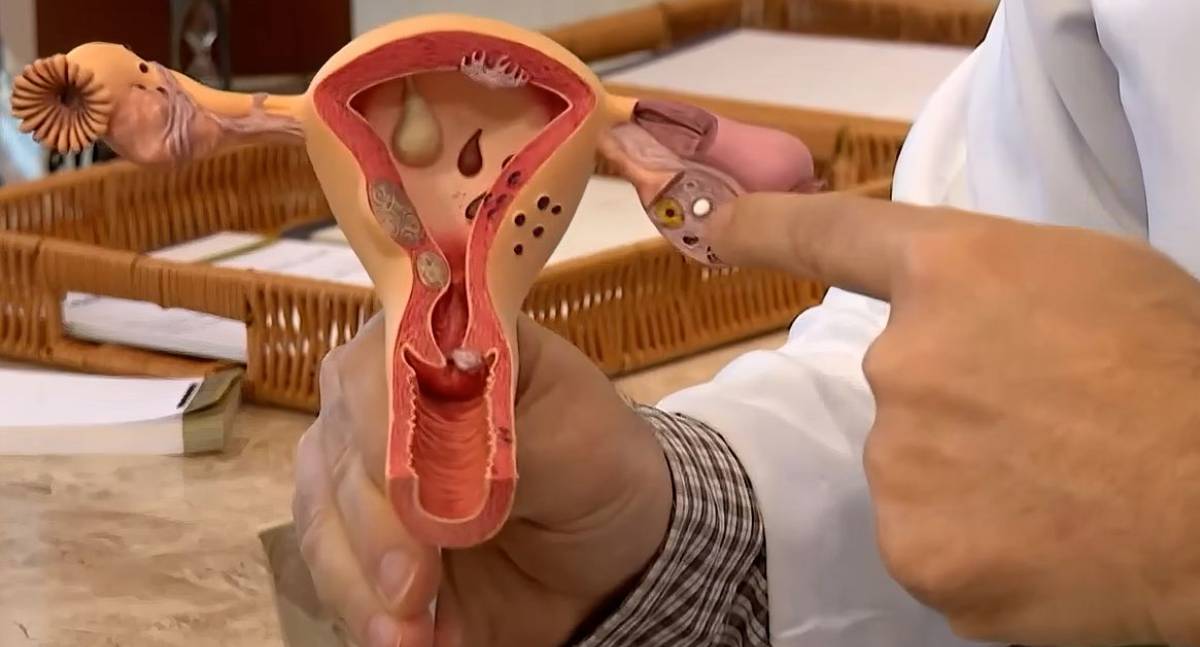CNPq abre chamada pública de sessenta milhões de reais para pesquisas sobre endometriose e saúde menstrual