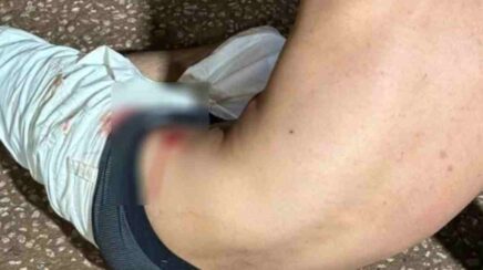 Homem de 22 anos é encontrado ferido após possível agressão em Porto Velho