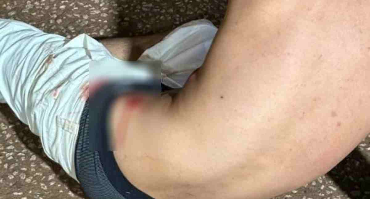 Homem de 22 anos é encontrado ferido após possível agressão em Porto Velho