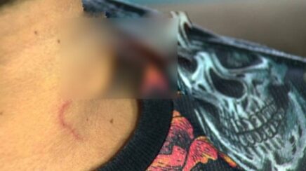 Mulher esfaqueia companheiro no pescoço para defender filha durante briga familiar em RO