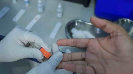 Porto Velho realiza mais de 26 mil exames de malária em 2026