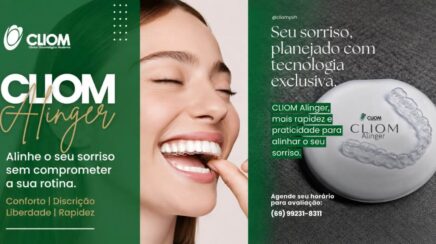 Agenda News: CLIOM Aligner sorriso alinhado com conforto