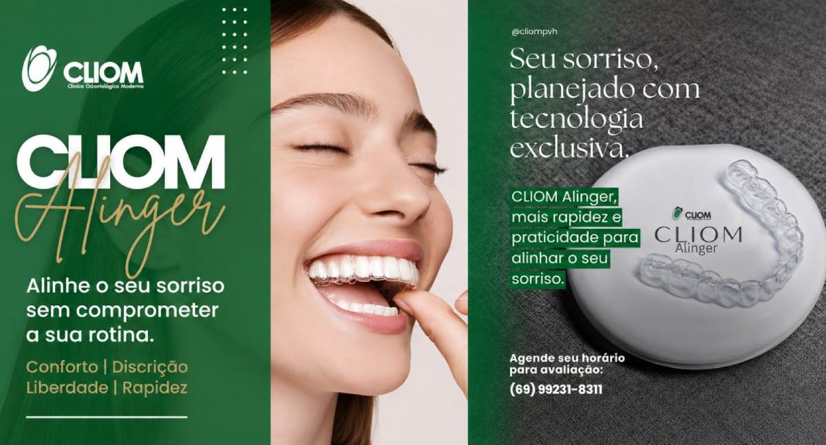 Agenda News: CLIOM Aligner sorriso alinhado com conforto