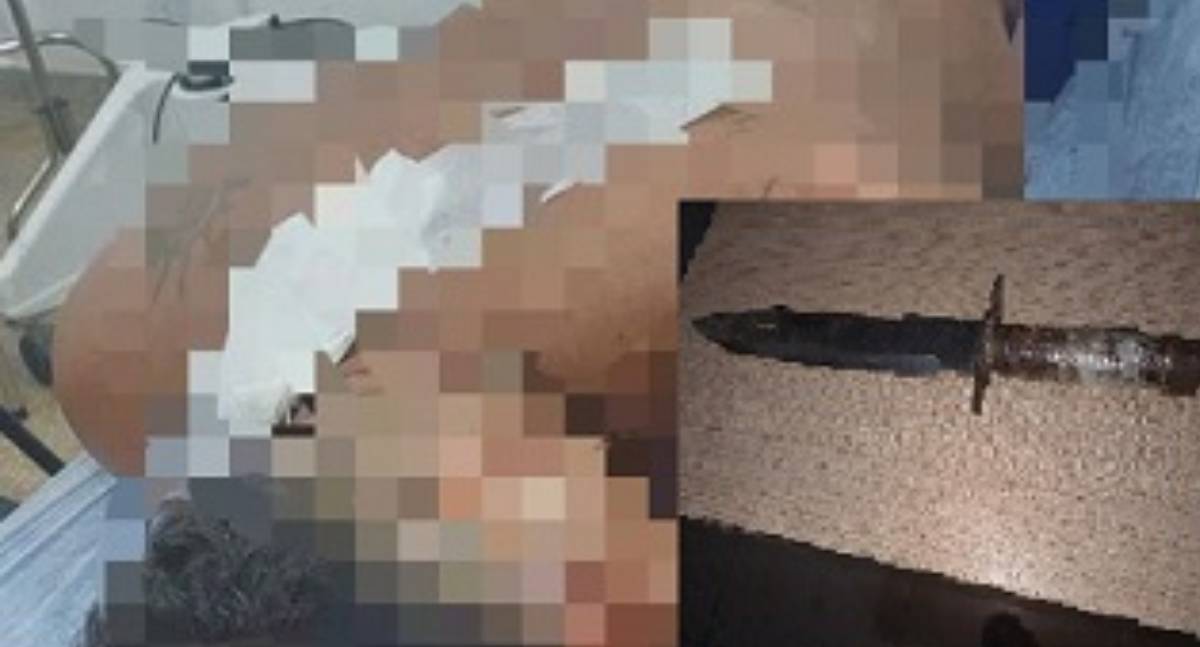 Briga entre irmãos termina com homem ferido por facada e paulada em município de Rondônia