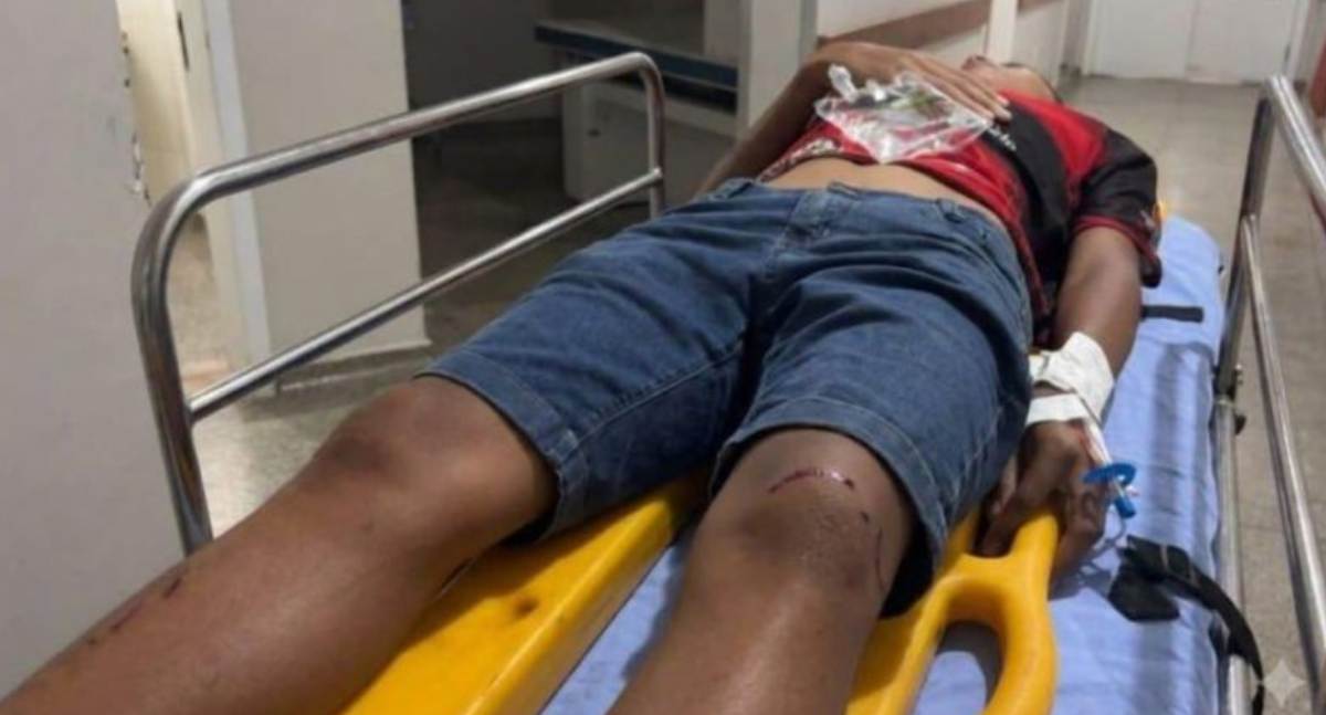 Motociclista fica ferido após colidir contra picape durante manobra na Rua Rondônia