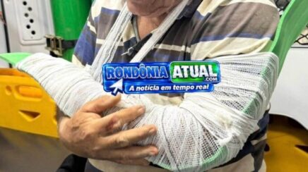 Motociclista fica ferido após sofrer queda em vicinal na zona rural